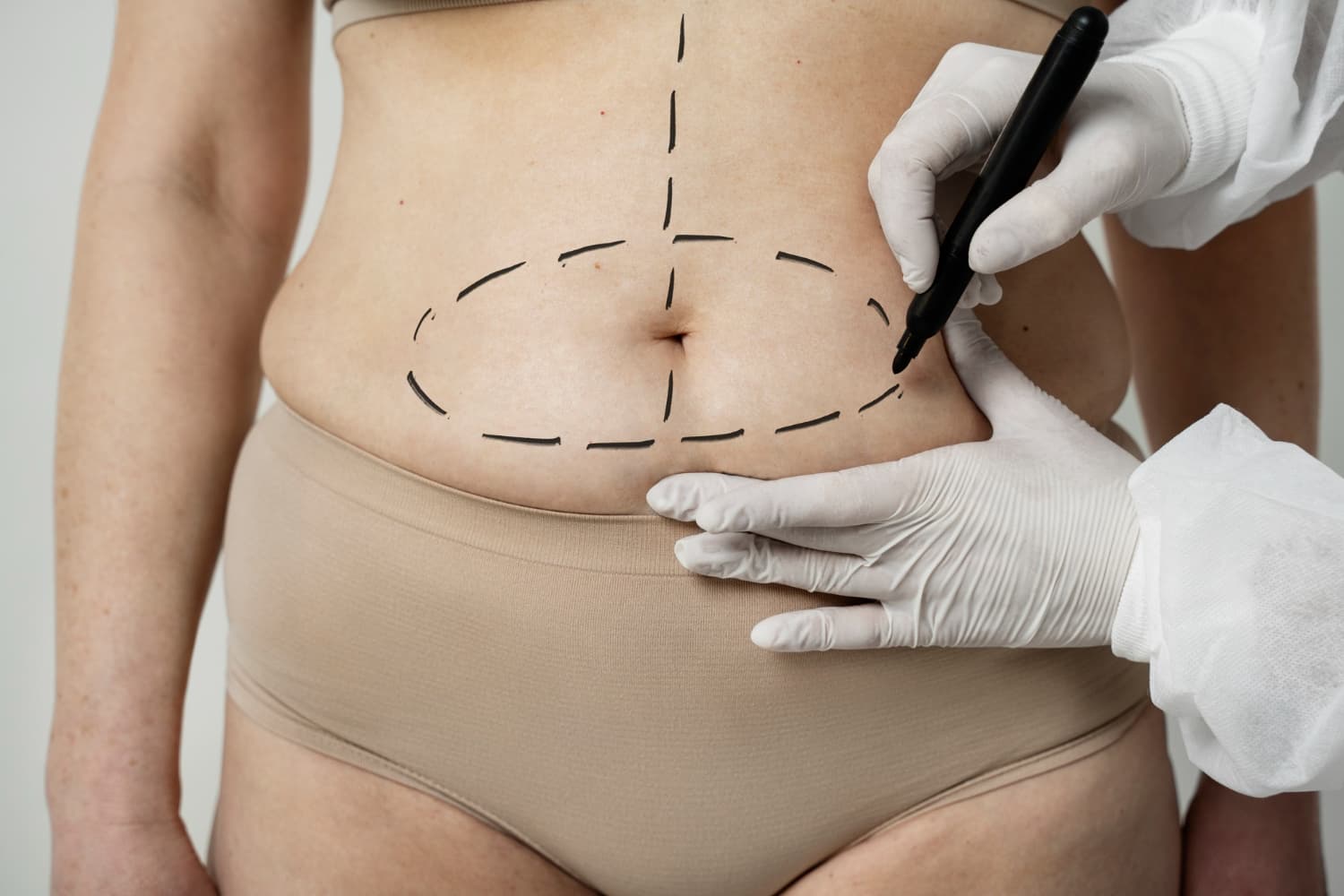 Vanquish Me™ body sculpting — Just Lose Weight MD