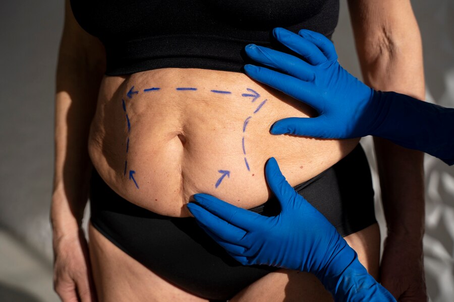 Provider guiding a body contouring device across a patient's skin